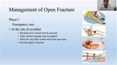 gusilo|Principles of management of open fractures